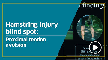 Hamstring injury blind spot: Proximal tendon avulsion