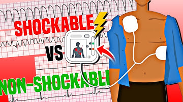 Shockable and Nonshockable ECG Rhythms | ACLS Rhythm Recognition