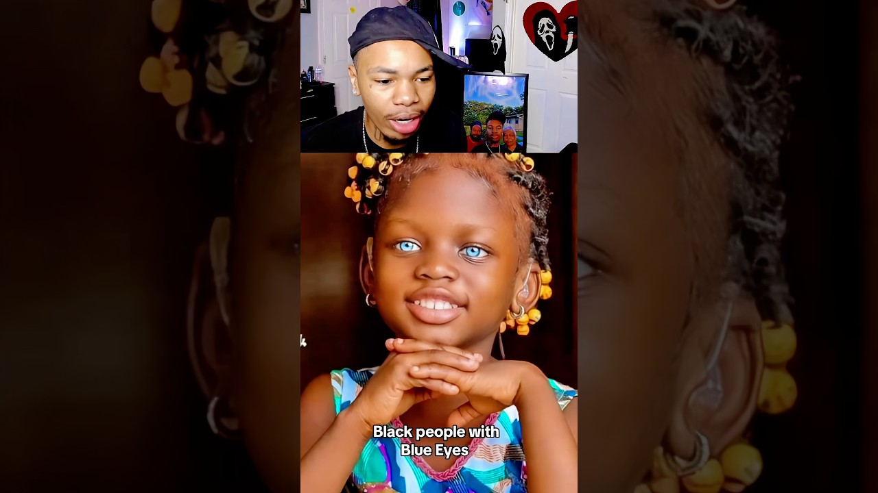 Black People Born with Blue Eyes 😳