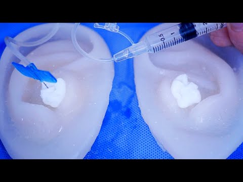 ASMR 긴급수혈 #3분팅글