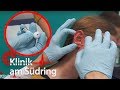 Kopfhörer explodiert im Ohr! Wie konnte das passieren? | Klinik am Südring | SAT.1