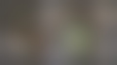 Small pupil Phaco with Stretch pupilloplasty - How to get by without intra operative pupil dilators.