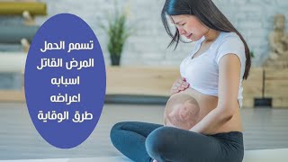 احذري مرض تسمم الحمل القاتل وكيف تتعرفي على اعراضه ومدى تأثير تسمم الحمل على الجنين