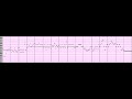 Latent constraints c major  high density transformation