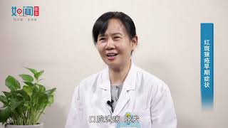 【风湿免疫科】红斑狼疮早期症状