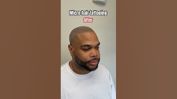 Micro hair tattooing #scalpmicropigmentation #smp #edmonton #hairtattoo #barber #hair #smptraining