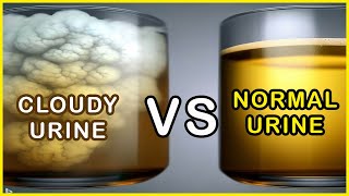 How to Identify a Cloudy Urine and Normal Urine