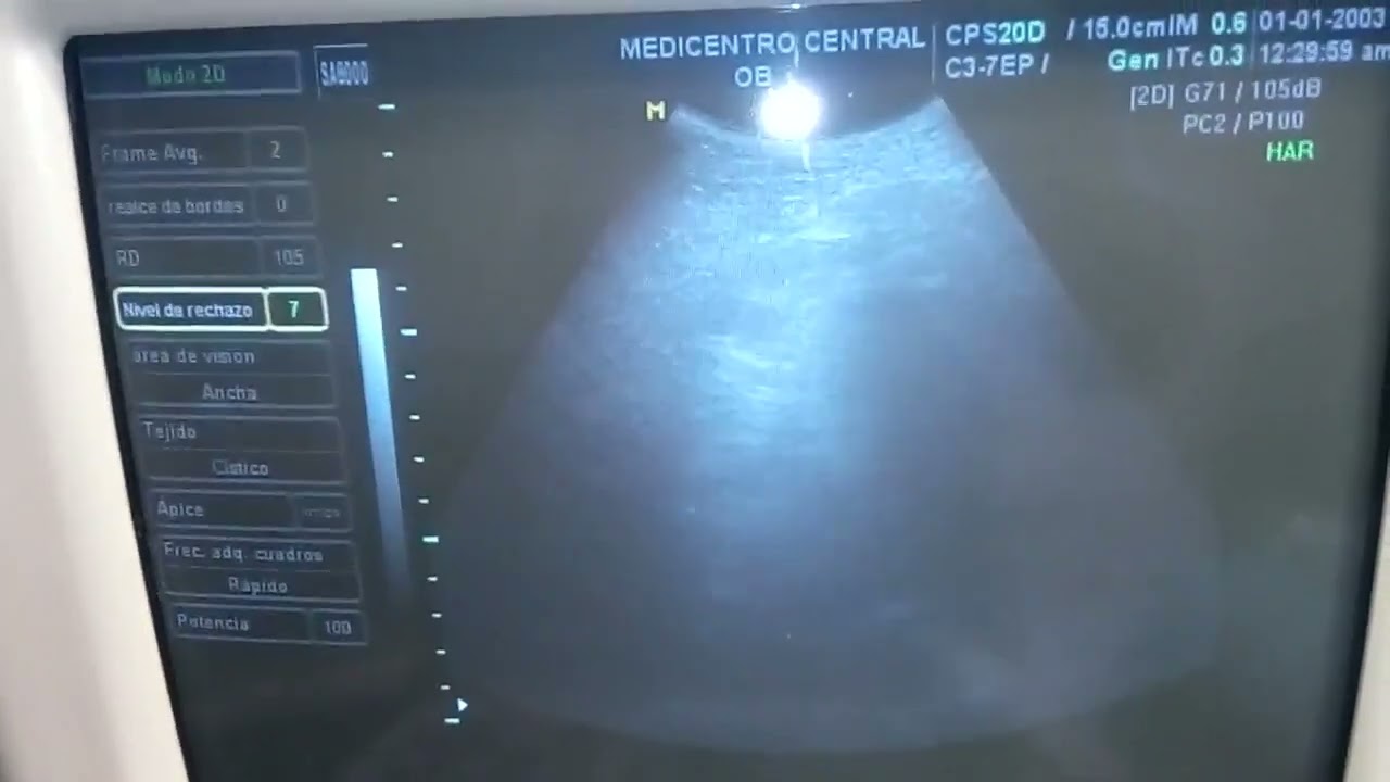 Medison Sonoace 8000 Live Prime SA8000Live / 20230419