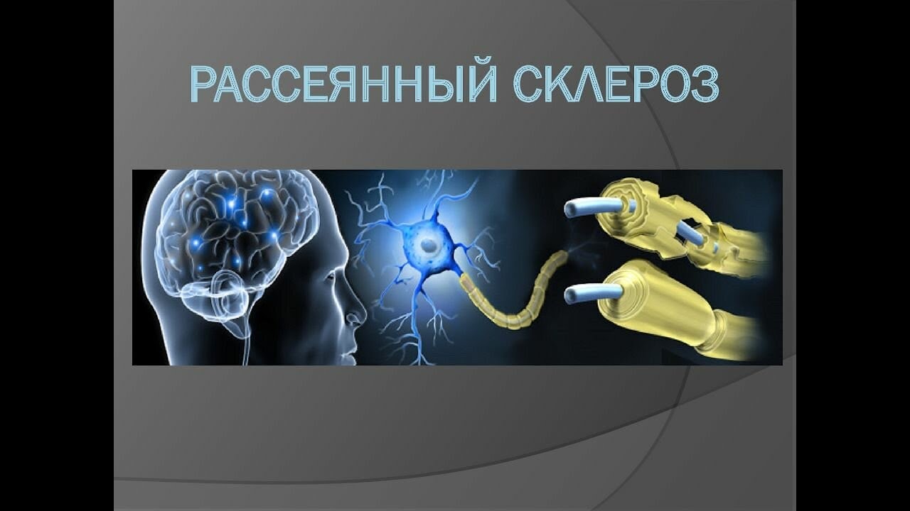 Комплекс упражнений при рассеянном склерозе. - YouTube