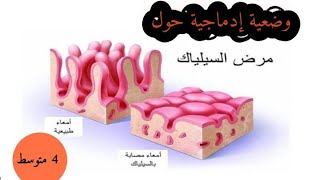 وضعية إدماجية مقترحة حول مرض السيلياك 4 متوسط