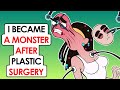I Became A Monster After Plastic Surgery At Age 18 | This is my story