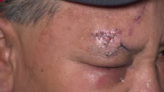 Celebrity Victims speak out after attackers go on stabbing, robbery spree in SE Houston Net Worth