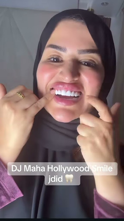 #sofiataloni DJ maha 3mlet snan jdadin 🦷🦷. #sofiataloni