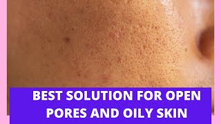 best solution for open pores and oily skin l skin care routine in summers