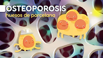 ¿Dónde siente la osteoporosis?