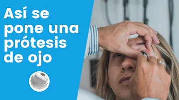 ¿Se puede parpadear con un ojo postizo?