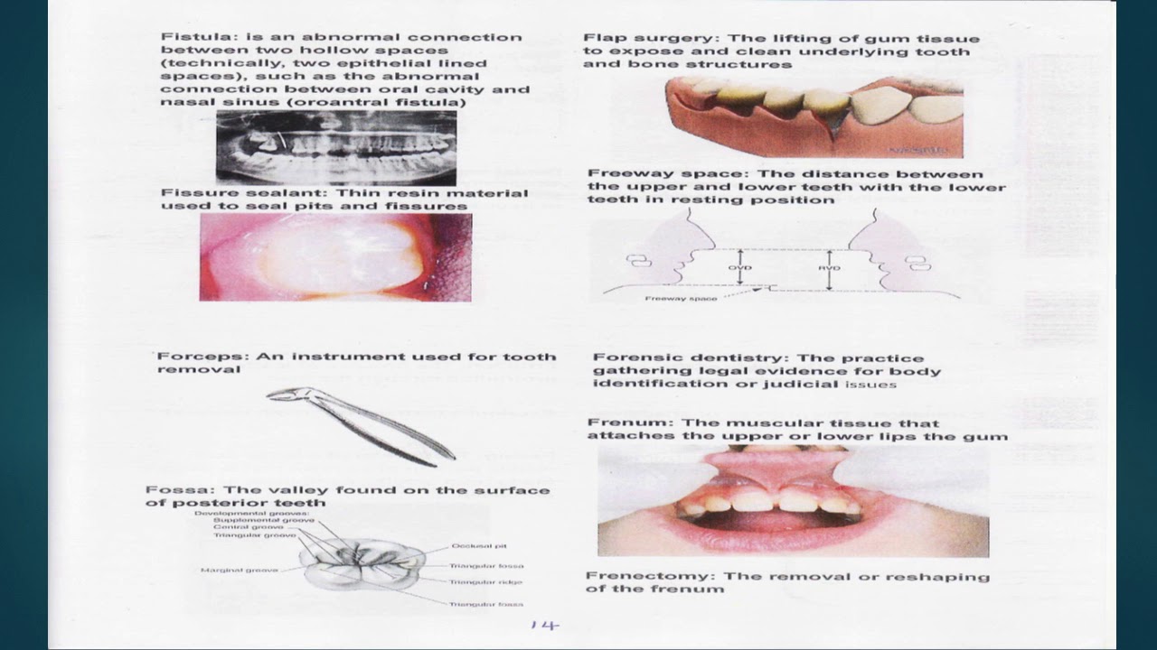 Dental Terms 1 YouTube