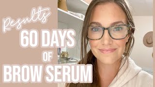 BROW SERUM BEFORE AND AFTER RESULTS | Sarah Brithinee