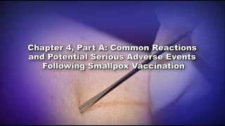 Chapter 4, Part A: Common Reactions and Potential Serious Adverse Events After Smallpox Vaccination