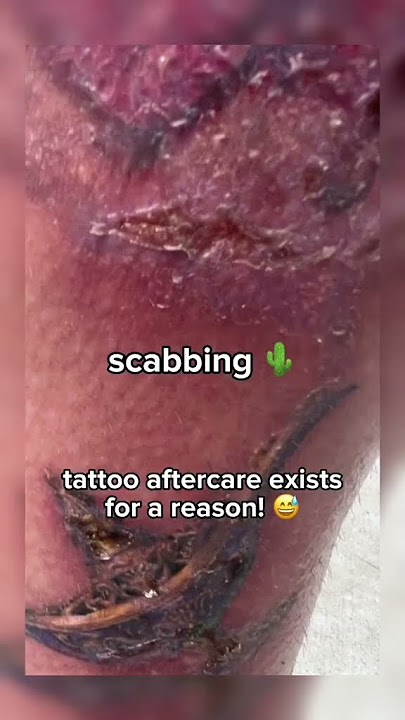 These 4 things may mean your New Tattoo is INFECTED | #tattooaftercare