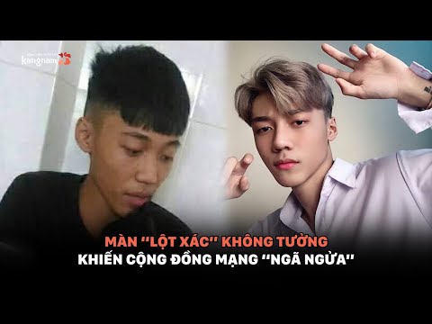 Video: 6 Cuộc Phẫu Thuật Thẩm Mỹ Phổ Biến Cho Nam Giới