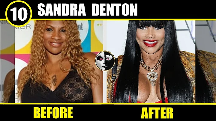 Sandra Denton Plastic Surgery Before and After - ( Botched Nose Job | Breast Implants | Butt Shots )