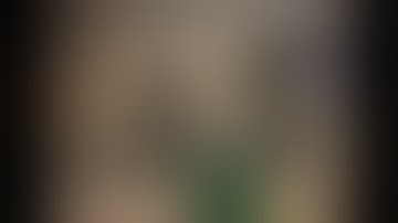 Our Experiments With (da Vinci) Xi:  Dr. Gagan Prakash