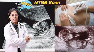 FIRST TRIMESTER ANOMALY SCAN | How I do it by Dr. Sakshi Bansal | FETAL IMAGING | BANASAL BONE