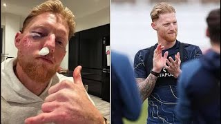 I might not be here’ — Ben Stokes reflects on frightening facial injury