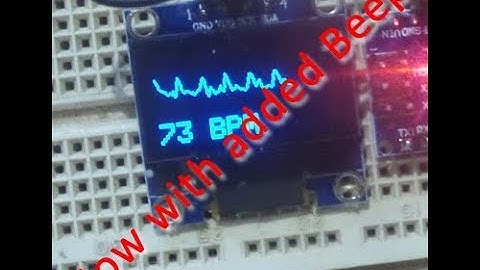Heart/pulse sensor with Arduino - Now with sound!