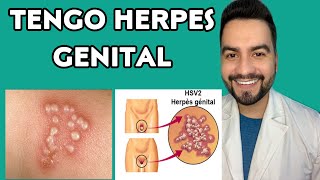 Tengo Herpes En Los Genitales Herpes Genital Dr David Campos