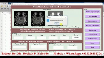 Matlab Code for Brain Tumor Type Detection and Classification Using Image Processing