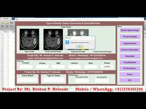 Matlab Code for Brain Tumor Type Detection and Classification Using Image Processing