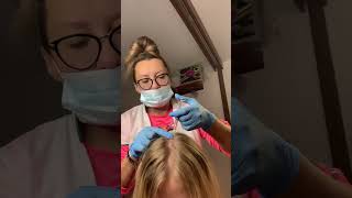 Download Lagu Łysiejesz?! Mezoterapia igłowa skóry głowy Dr. Cyj MP3