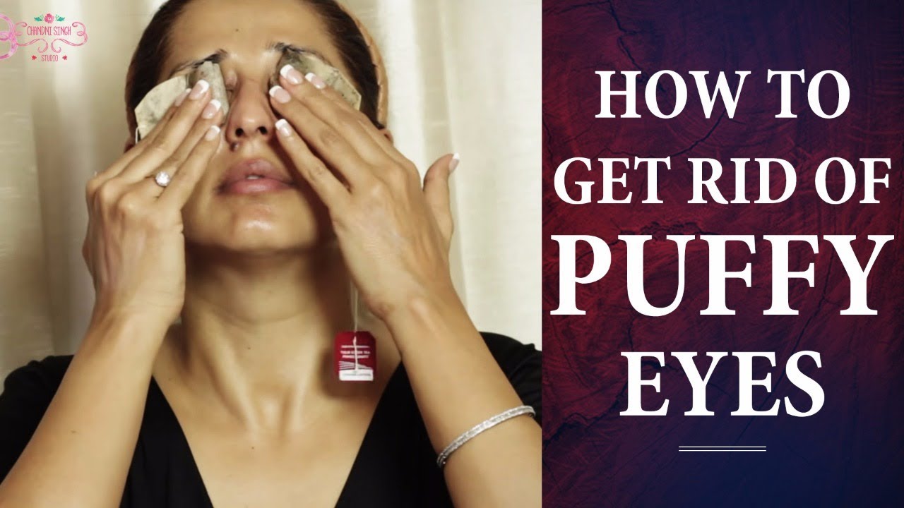 How to Remove UNDER EYE WRINKLES | Home Remedies For Puffy Eyes ...