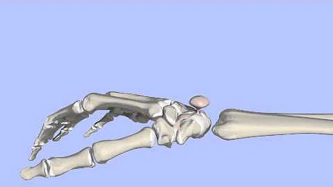 Co je ganglion v medicíně?