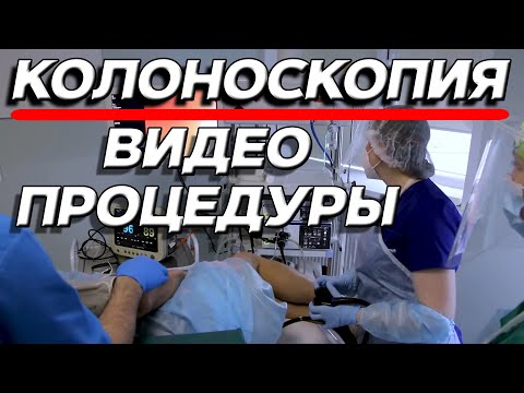 Колоноскопия под наркозом: как проводится исследование