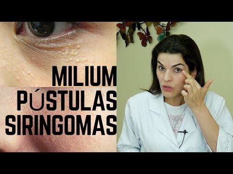 Vídeo: Quando uma pústula desaparece?