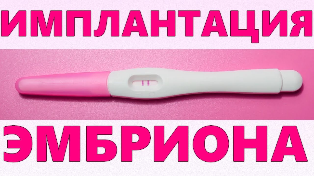 ПРИЗНАКИ ИМПЛАНТАЦИИ ЭМБРИОНА | Прикрепление плодного яйца в начале ...