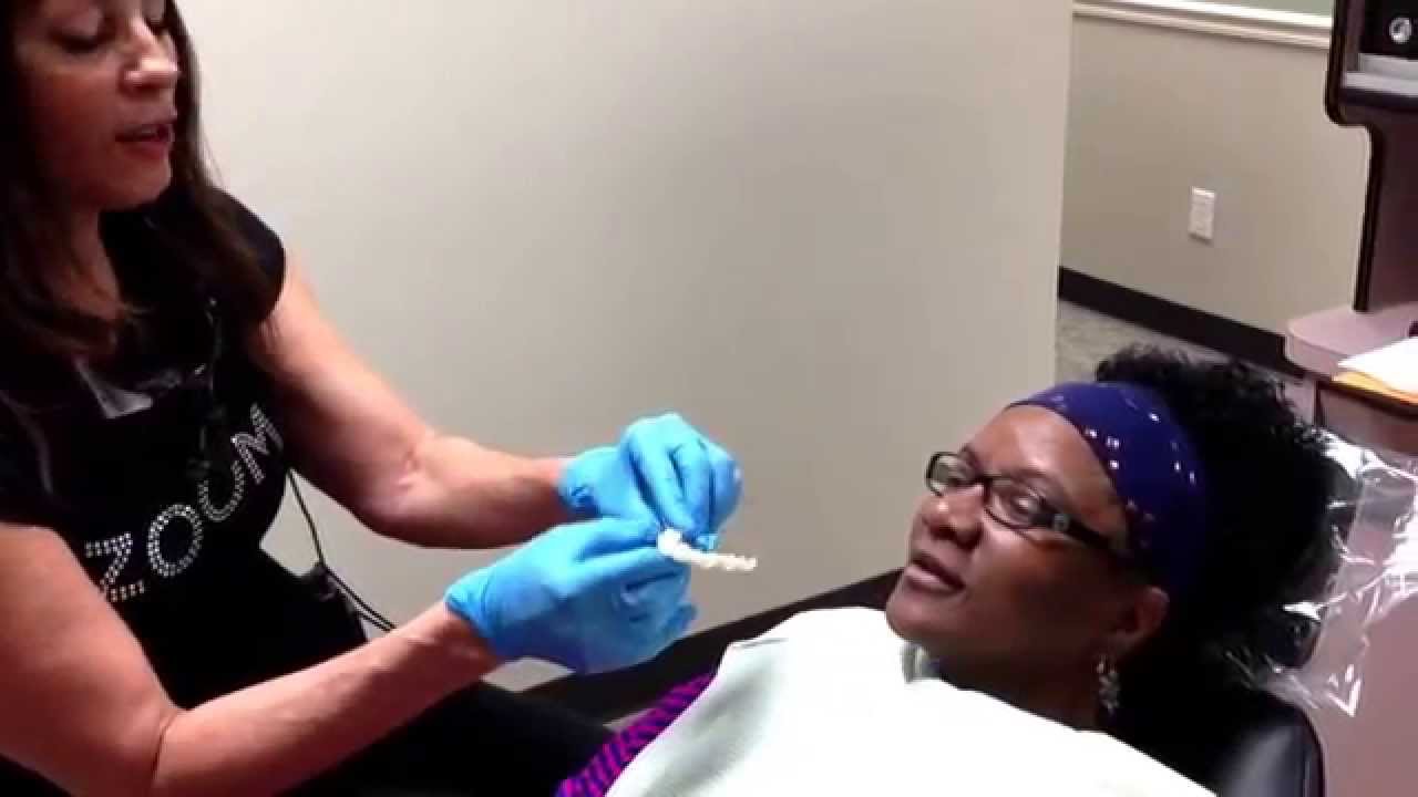 Houston Cosmetic Dentist , The TexasToothLady,..Amazing Dental Makeover