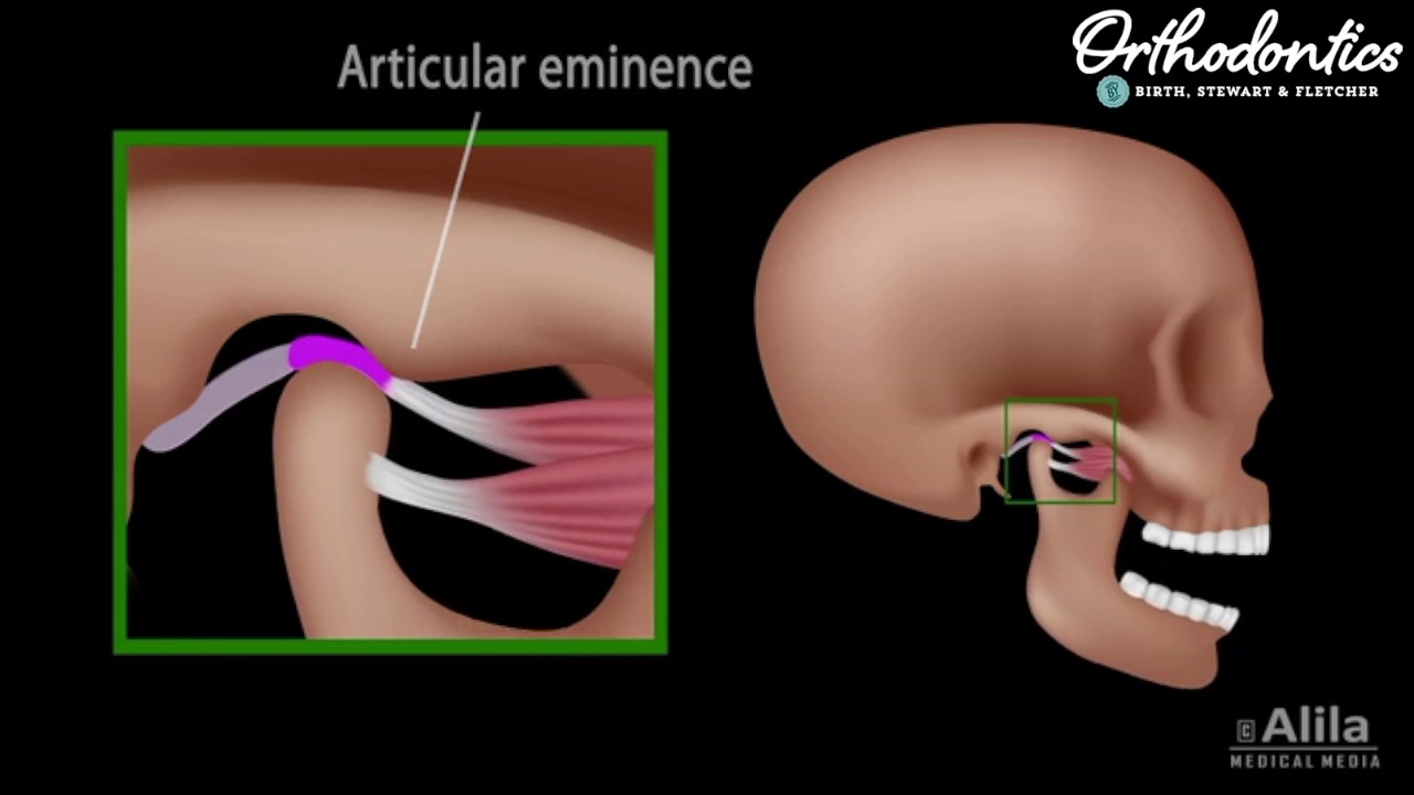 How Can Orthodontics Help With Jaw Clicking? | Orthodontics by Birth &