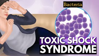 Symptoms of Toxic shock syndrome - MEDizzy