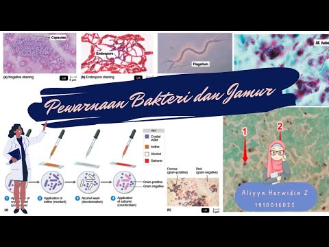 1910016022 - Aliyya Herwidia Z - Video Tutorial Praktikum Mikrobiologi Pewarnaan Bakteri dan Jamur