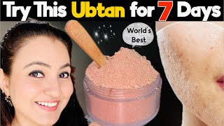 Worlds Best Homemade Ubtan For Soft Glowing Radiant Skin Reduce Acne, Pimples & Open Pores