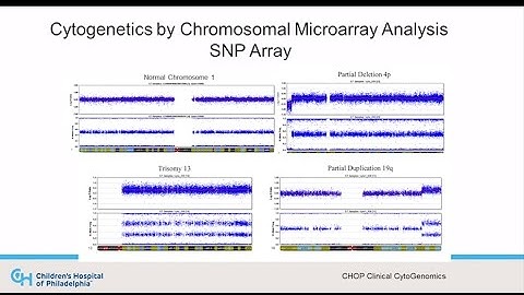 12  Chromosomal microarray testing