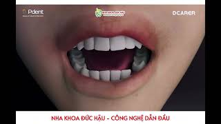 KHÁCH HÀNG NHẬN ĐƯỢC GÌ VỚI DCARER NAVIGATION GEN 6 #nhakhoaduchau #nhakhoauytinthaibinh