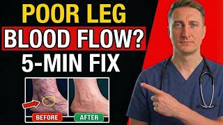 Poor Leg Circulation? 30-Second Test + 3 Fast Fixes for Better Blood Flow