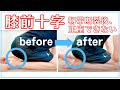 【実録】サッカーで前十字靭帯（ACL）断裂！手術後から膝が最後まで曲がらず、しゃがめない患者さん。筋肉、関節、皮ふの癒着に対する手技で完治を目指す方法。