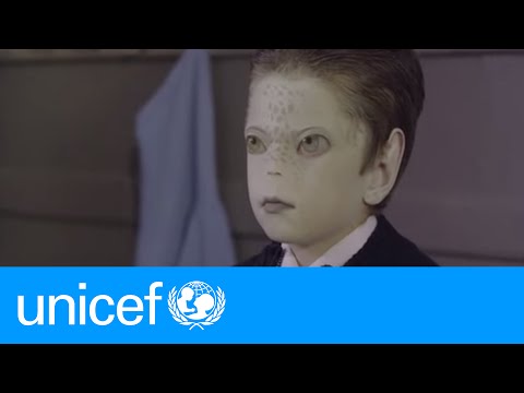 Marciano: An unexpected friend | UNICEF