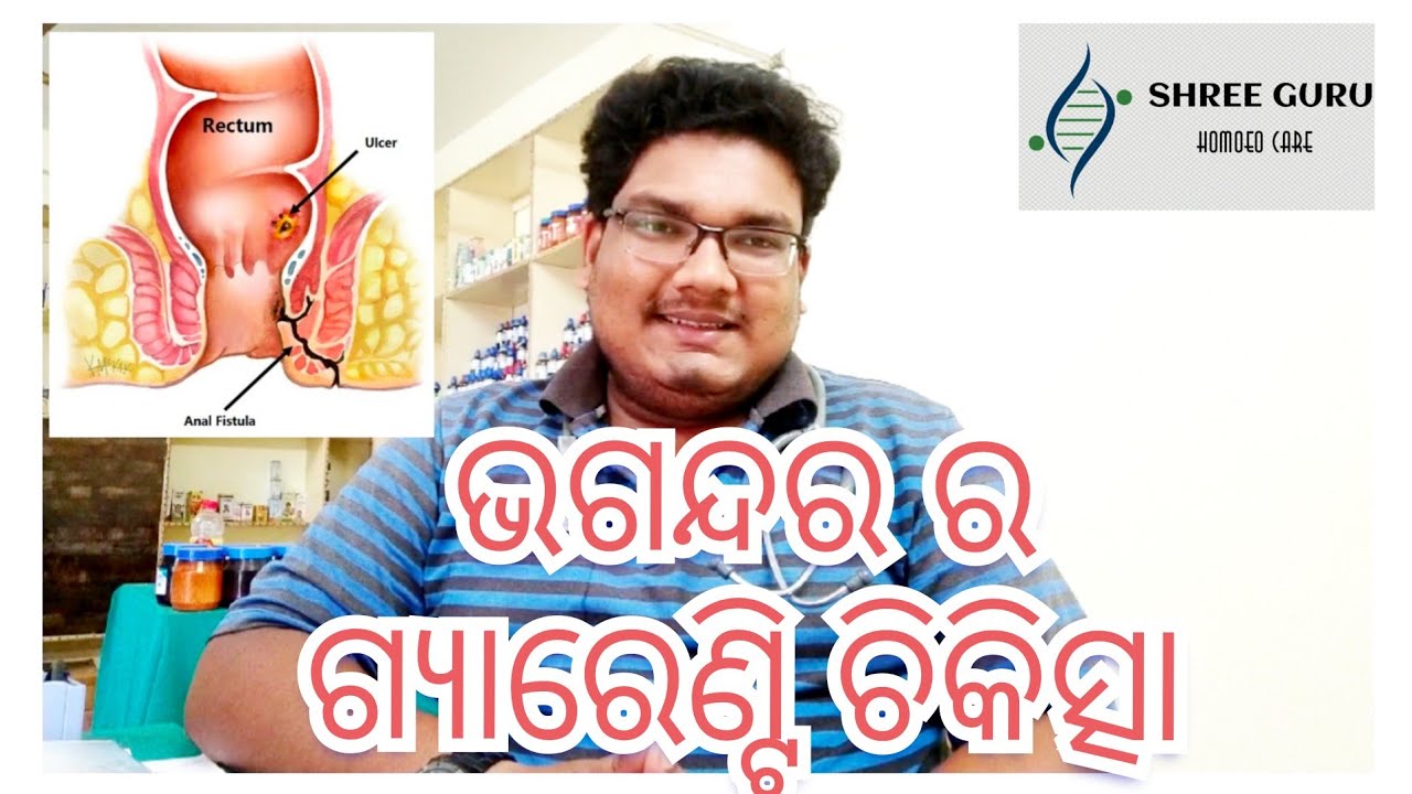 Fistula/Bhagandara/Fistula homoeopathic treatment/Homoeopathic treatment of fistula in oriya/ଭଗନ୍ଦର